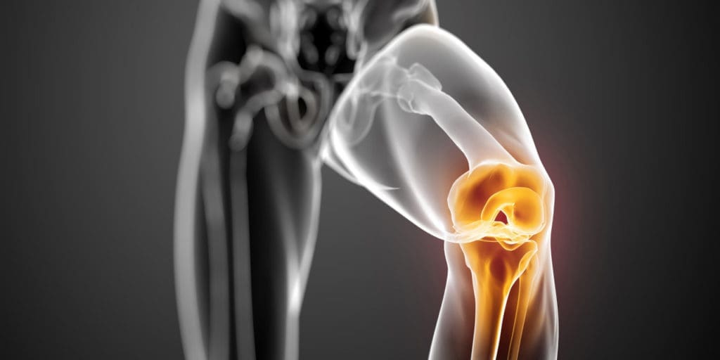 A close up of an x-ray image of the knee joint